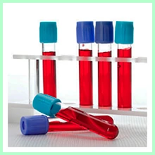 Anemia Anemia