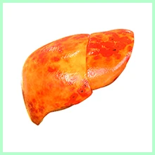 Cirrhosis of the Liver