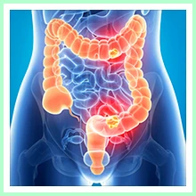 Enterocolitis