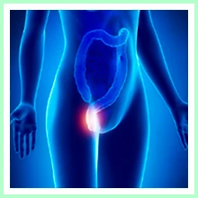 Hemorrhoids