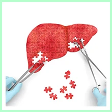 Hepatitis