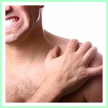 Neuritis