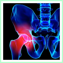 Osteoporosis Osteoporosis