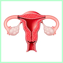 Ovarian cysts Ovarian cysts