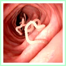 Parasitic Infections